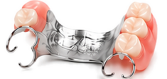 Chrome Partial Denture, Dentures Direct