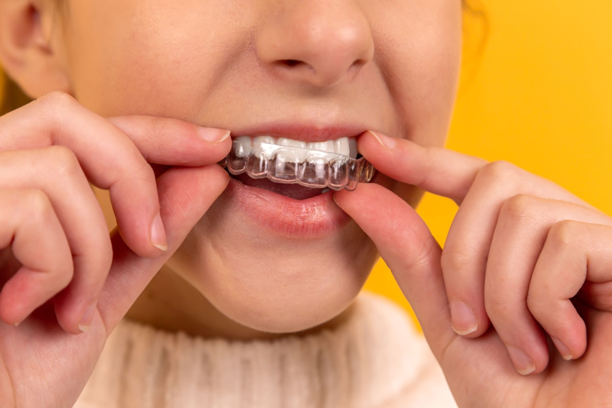 Mouthguards & night guards